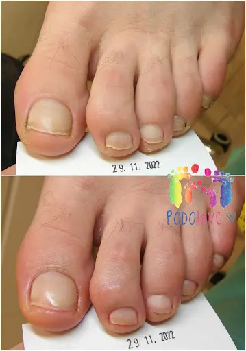 PODOlove Leszno Team - pracownia podologiczna